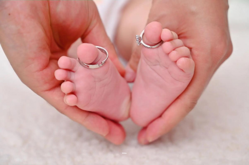 黑龙江孕妇怎样预防妊娠纹